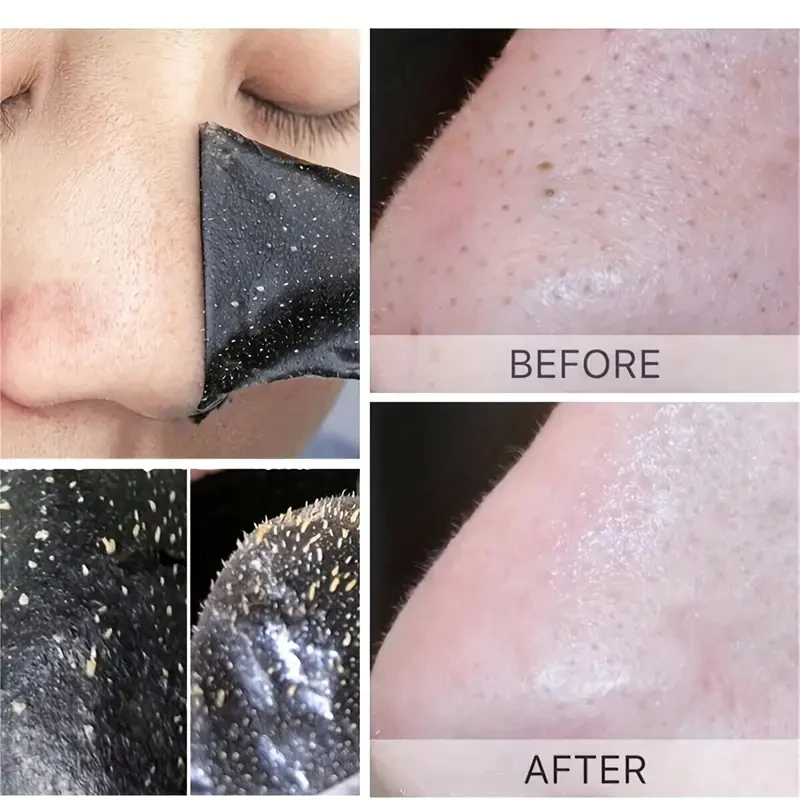 Nez points noirs enlever masque plâtre nez bandes enlever points noirs Pores points noirs dissolvant acné Peel masque Patch de nettoyage soins de la peau
