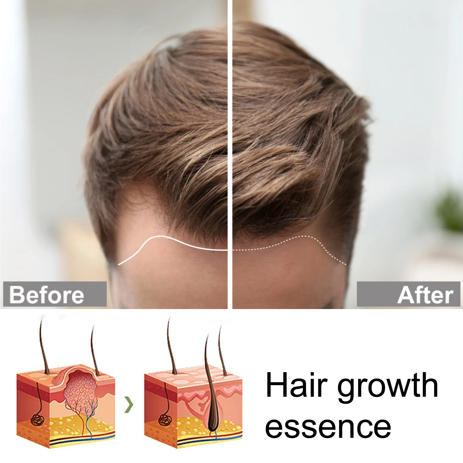2026 Rosemary Hair Growth Roller Essence Scalp Health Stimulator Follicle Activity Enhancer Breakage Reducer Density Booster