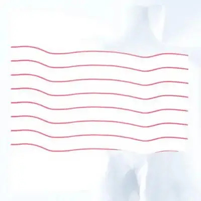 

8 Pcs Yangqin Tube Rubber Band Chinese Dulcimer Replacement Part Repair Instrument Accessories Pink Kit