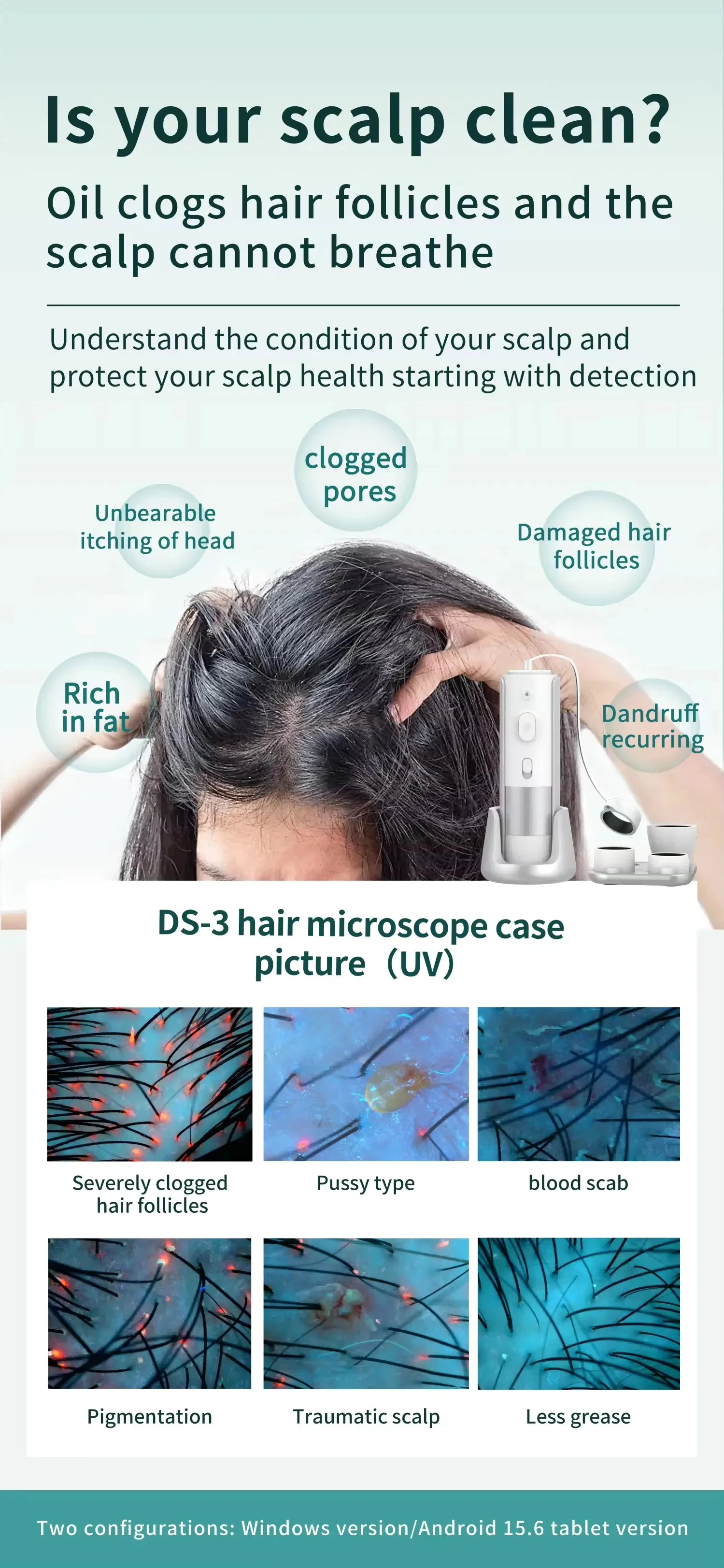 High Quality HD Hair Follicles Scalp Scanner Detector Hair Analyzer Skin Scalp Hair Analysis Machine For Beauty Salon