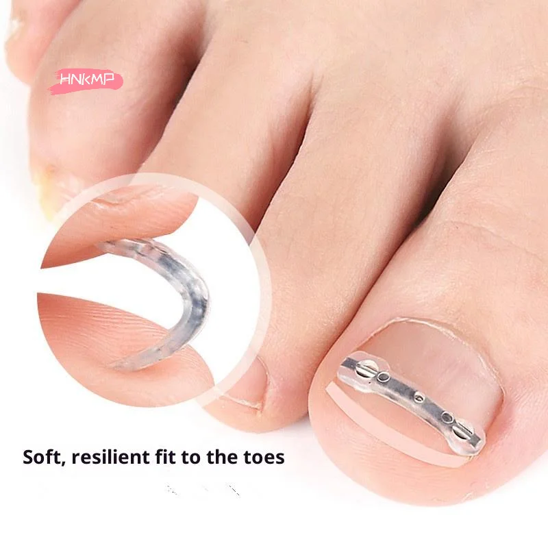 Corrector de uñas encarnadas profesional, herramienta para pedicura, tratamiento de uñas de los pies, Clip alisador incorporado, soporte para recuperar el cuidado de los pies