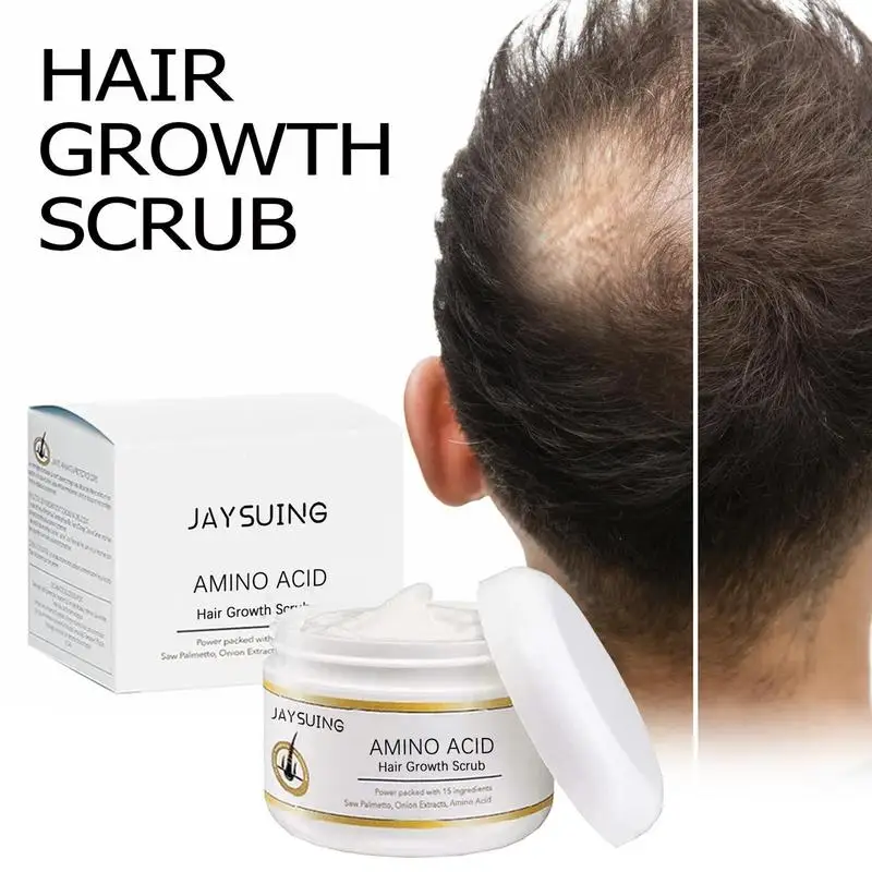 Hair Scrub For Scalp Scalp Scrub For Hair Growth 50g Exfoliate And Volumize Hair Scalp Scrub For Hair Loss Alopecia Areata Big