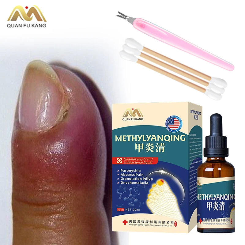 

Paronychia Treatment Liquid Nail Fungus Cleaner Nail Ingrown Correction Onychomycosis Toenail Fungal Care Tools American Formula