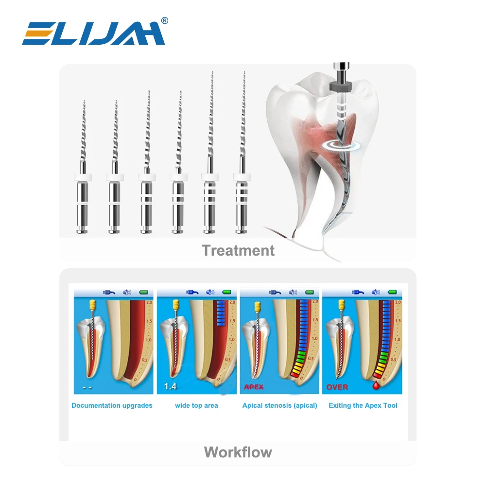 6Pcs/Box Dental Retreatment Engine Root Canal NiTi File Denspay D1-D3 NiTi Super D Rotary Files For Root Canal Cleaning Tools