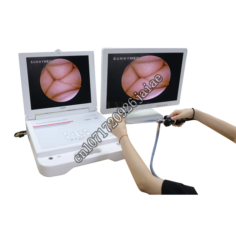 

SY-PS045N Portable Hysteroscope Endoscope Camera System Urology Endoscopy with Light Source