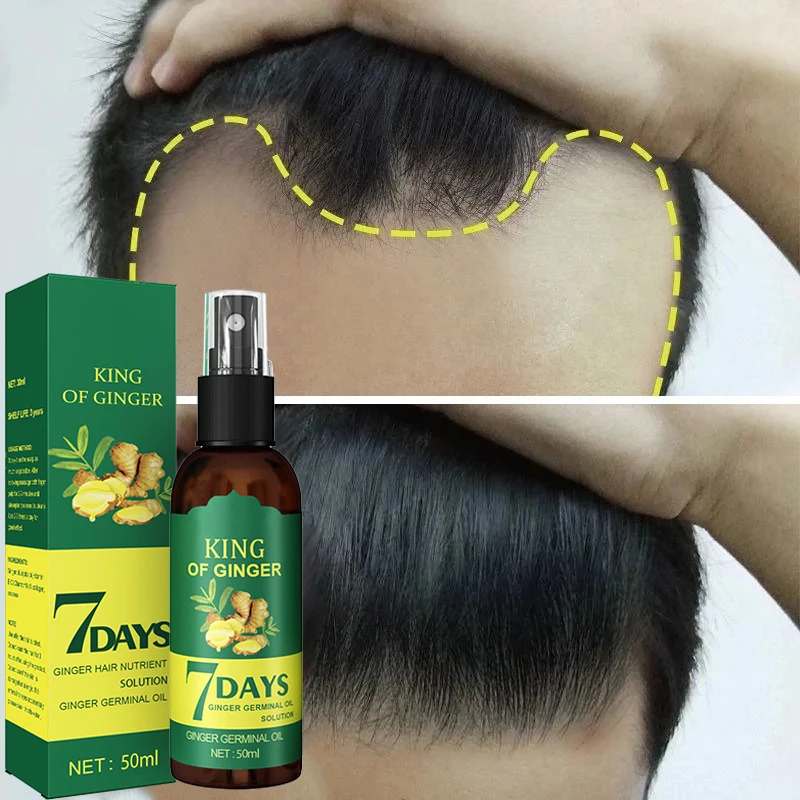 30/50ml Ginger Rapid Hair Growth Serum Effectively Treat Alopecia Serum Strong Hair Roots Hair Dense Growth Essence Scalp Repair