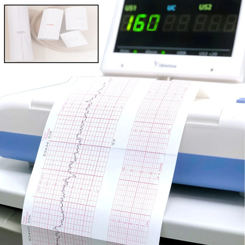 Thermal paper ECG EKG Machine 50mm*20m/80mm*20/110mm*20m /210mm*20m Electrocardiograph Thermal Printer Paper