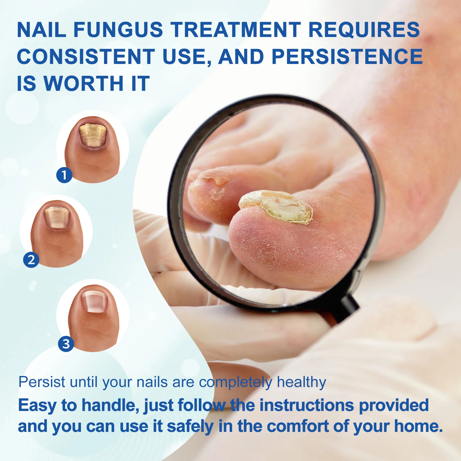 Professional Nail Fungus Laser Treatment Device Fungus Fast Repair Onychomycosis Toenail Laser Device Nail Mushroom treatment