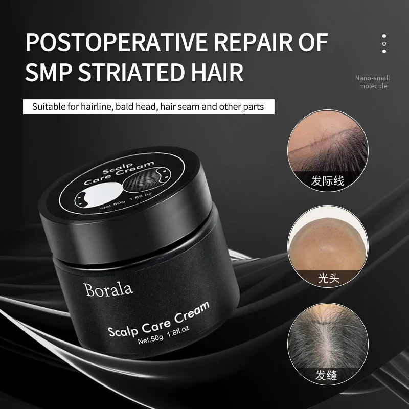 

Borala SMP Scalp Care Cream Hair Itching Repair Scalp Cleaning Oil Control Antipruritic Hair Care Lock Color Fixation After SMP