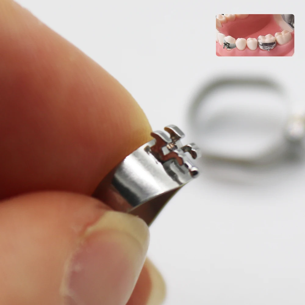

4Pcs Dental Orthodontic Bands Bicuspid Plain Bands 1st Molar Bands Bicuspid Band Prewelded With Bracket Brace 0.022 Roth