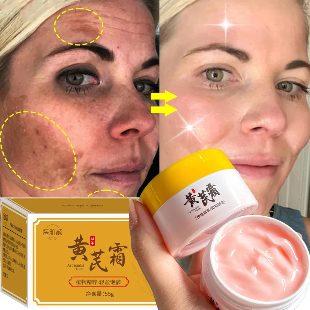 

Astragalus Whitening Freckles Face Cream Remove Dark Spots Melasma Lighten Melanin Acne Scars Anti-aging Brighten Skin Care 55g