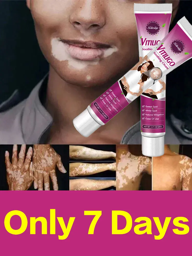 Vitiligo Cream The Skin Repair