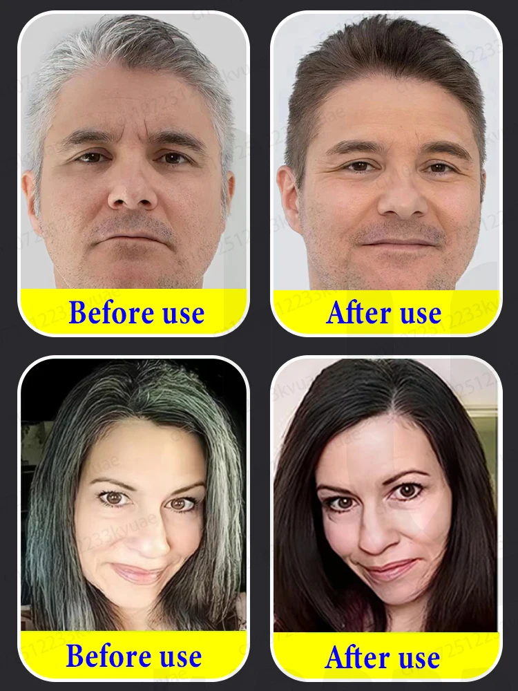 Gray hair can be quickly removed in 7 days, restoring hair to its original color. Suitable for people of all ages.