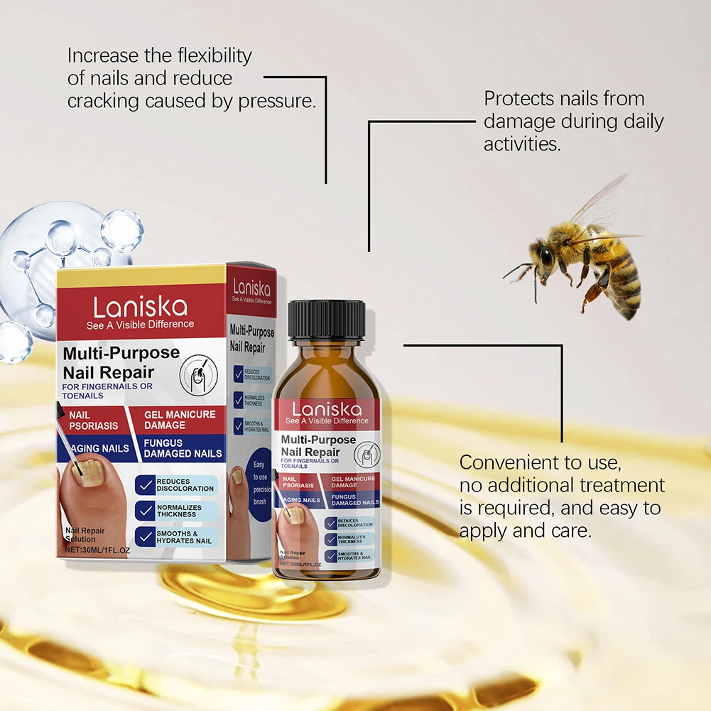 Nagellösung für Nägel mit verfärbten Schäden stellen die Verfärbungsdicke wieder her. Pflege in Salonqualität