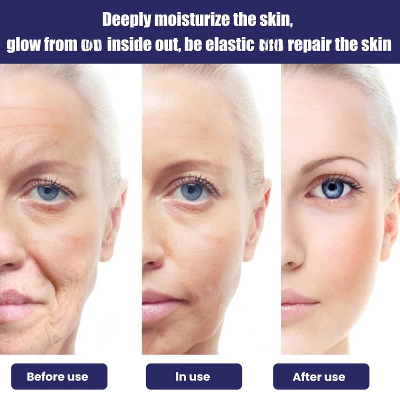 Feuchtigkeit spendende Gesichts creme Falten entferner dunkle Flecken heben straffen verblassen feine Linien Anti-Aging-Bleaching aufhellen Haut kosmetik