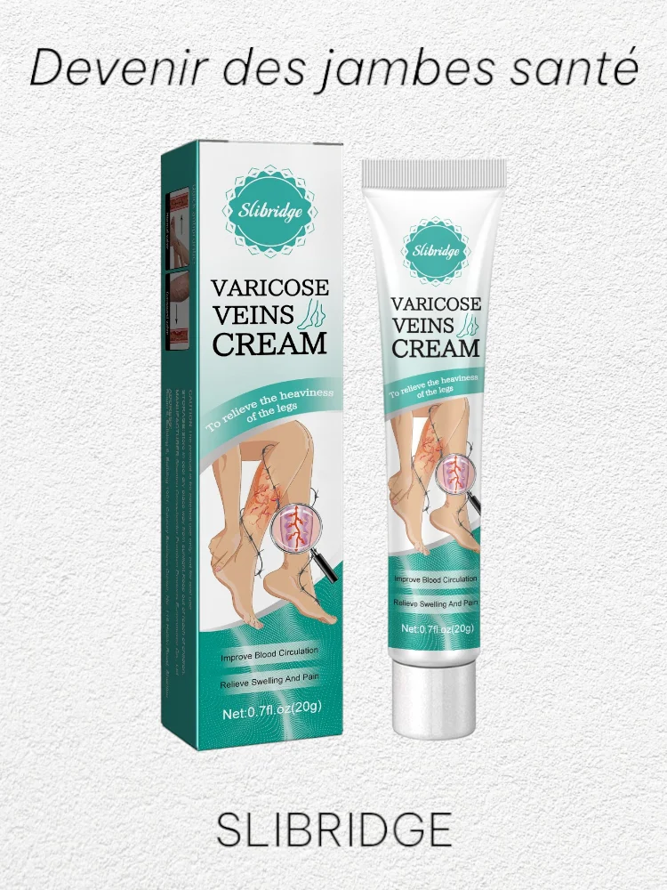 

Varicose Vein Treatment for Legs