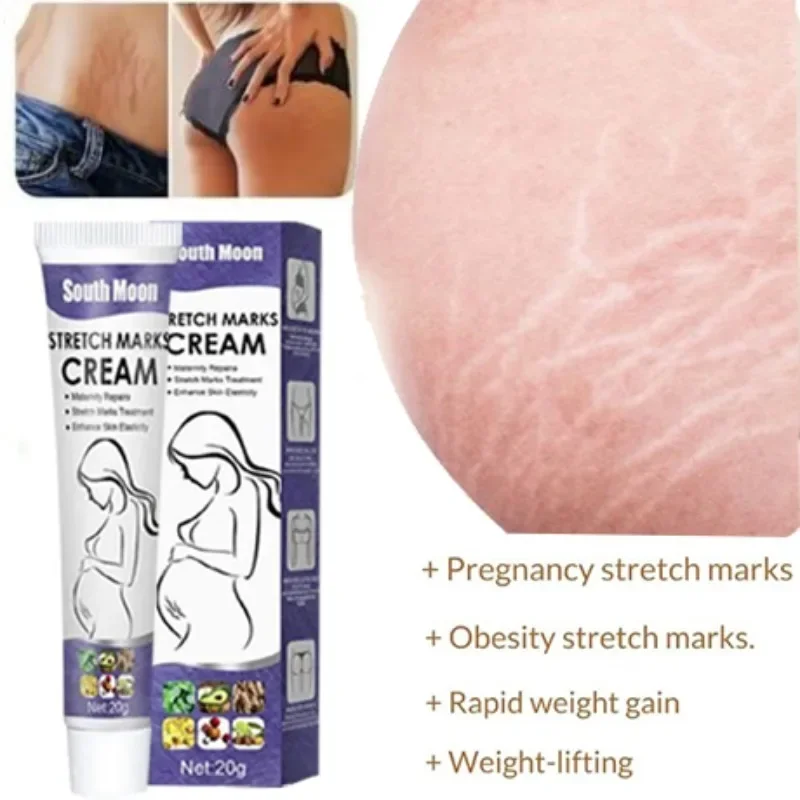 

Stretch Marks Permanent Removal Cream: Eliminate Body and Belly Stretch Marks, Swelling Marks. Remove Skin Cracks and Provide