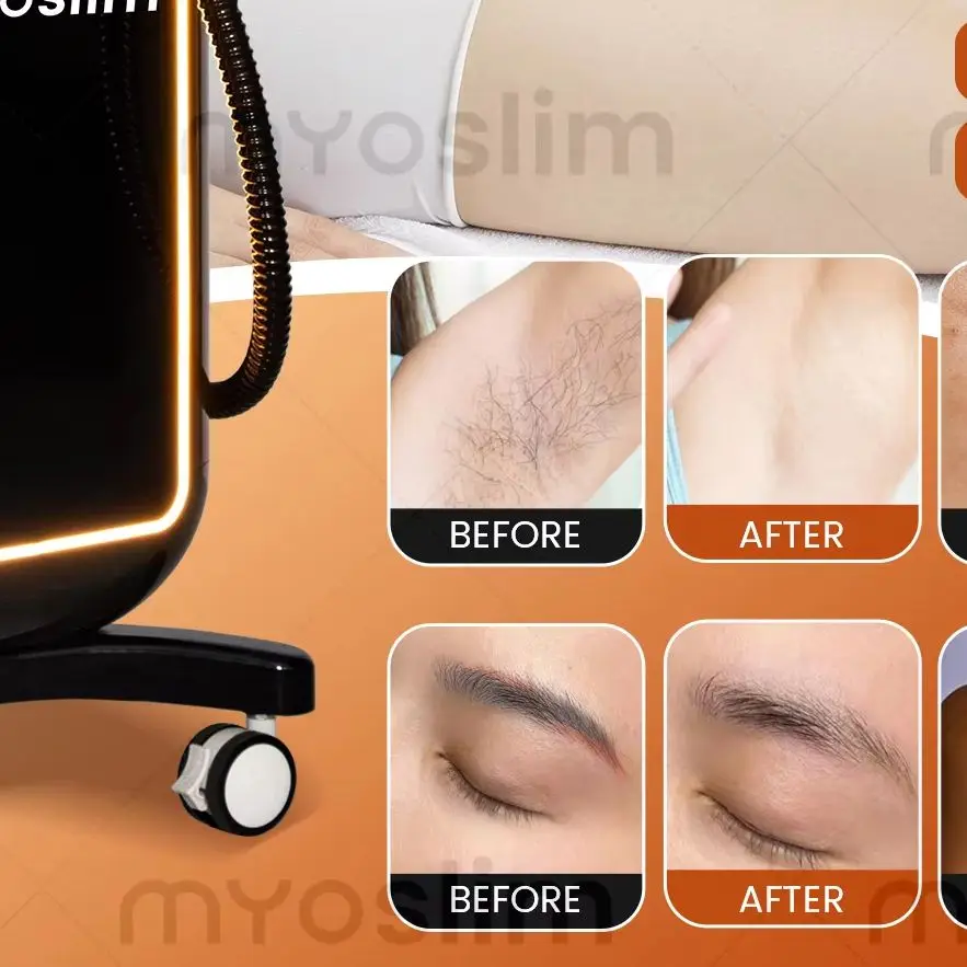 Multifunctional 4 IN 1 Diode Lase Hair Removal Picosecond Tattoo Removal RF IPL Acne Skin Care Beauty Equipment