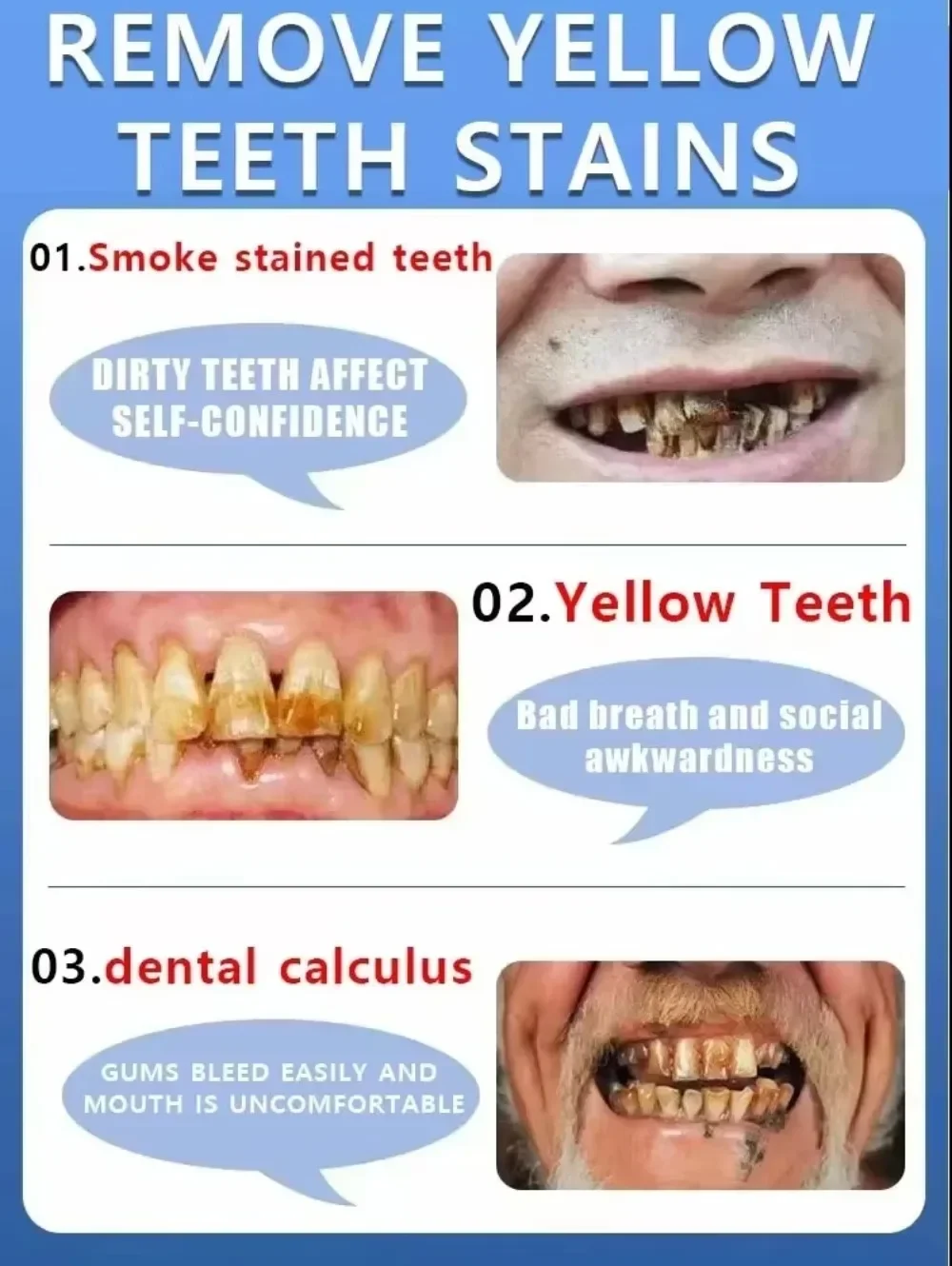 إصلاح الأسنان، ويمنع تساقط الأسنان، وإزالة لوحة الأسنان بشكل فعال #6