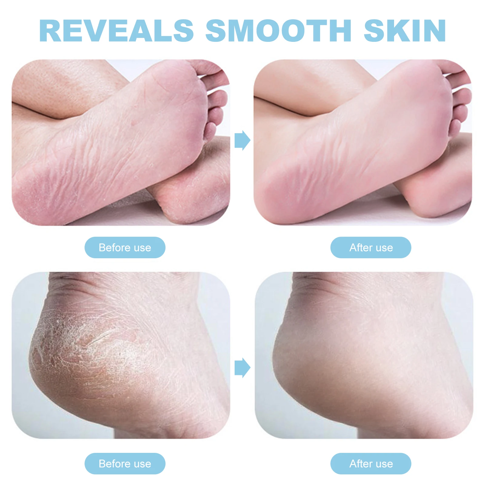 

Pedicure File High-Grade Callus Remover Portable Dead Skin Cleaner Foot Scrubber Exfoliating Tool Foot Care Supply
