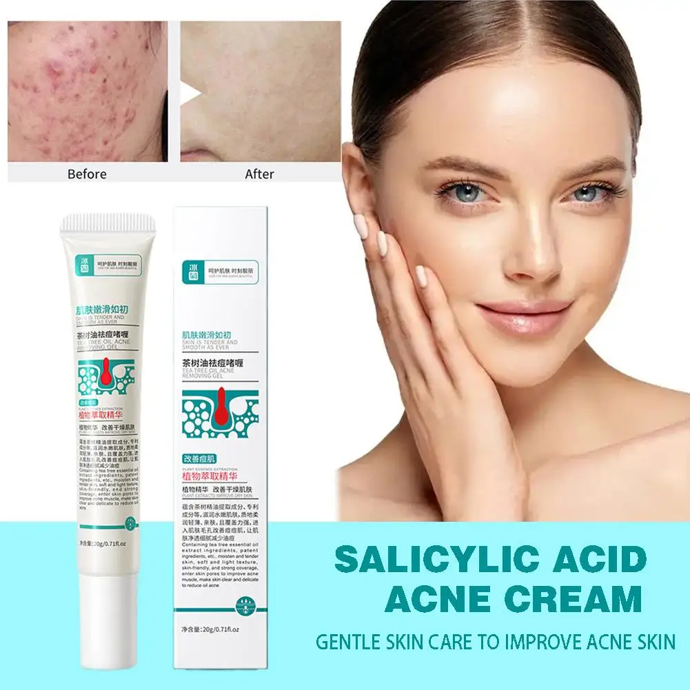 Creme anti-inflamatório do óleo da árvore do chá, reduzir espinhas da acne, controle das nádegas, equilíbrio delicado, umidade da pele, anti-inflamatório, 20g, S V5U5