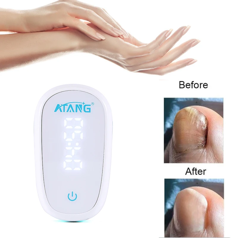 Atang – dispositif Portable pour les ongles, traitement des champignons, Infection au Laser, couleur grise