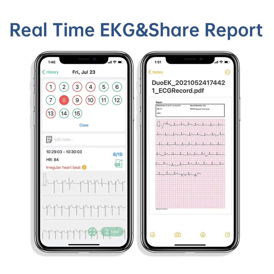 Handheld ECG Monitor for Wireless Bluetooth Heart Without metal Electrodes Home Use EKG Monitoring ios Android Recording