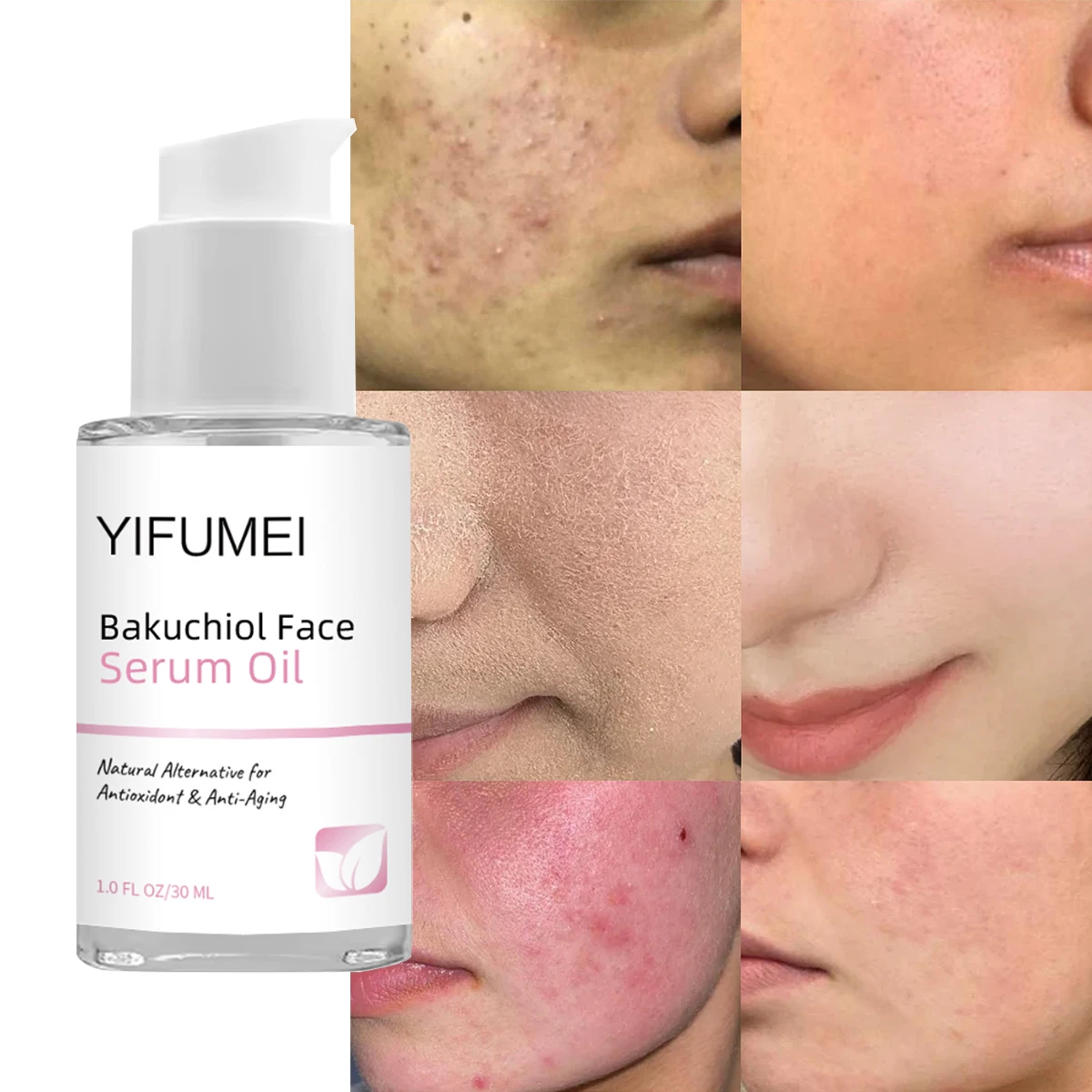 Bakuchiol Face Serum Oil Blemishes Dark Spot Pigmentation Anti-Inflammatory Moisturizing Anti-Acne Bakuchiol for Facial Care