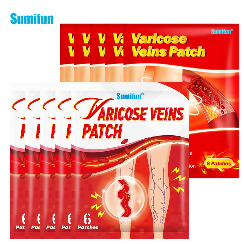 

Sumifun 2Type 30Pcs Varicose Veins Patch Varicosity Angiitis Spider Removal Plaster Vasculitis Phlebitis Swelling Relief Sticker