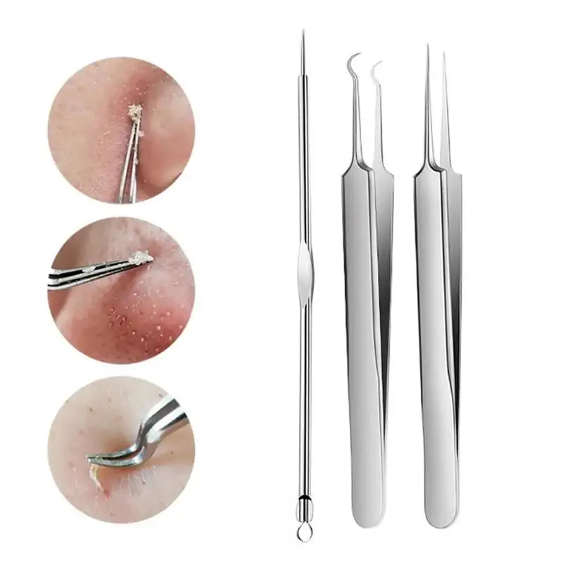 3PCS Acne Needle Set Stainless Steel Blackhead Removal Tool Skin Care Tools