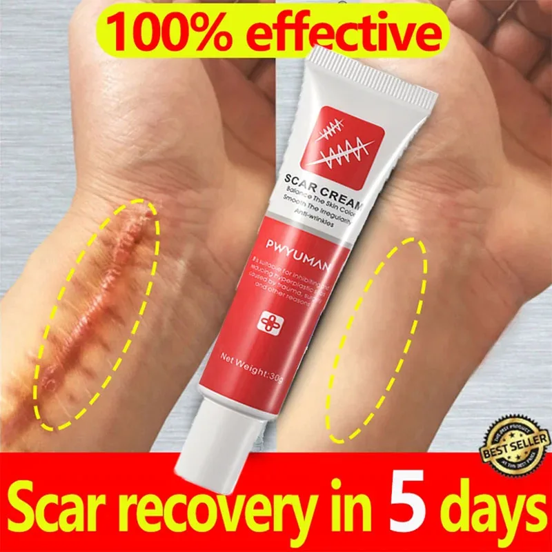 Herbal Scar Removal Cream Stretch Marks Burn Surgical Scars Treatment Gel Acne Spot Moisturizing Repair Facial Body Skin Care