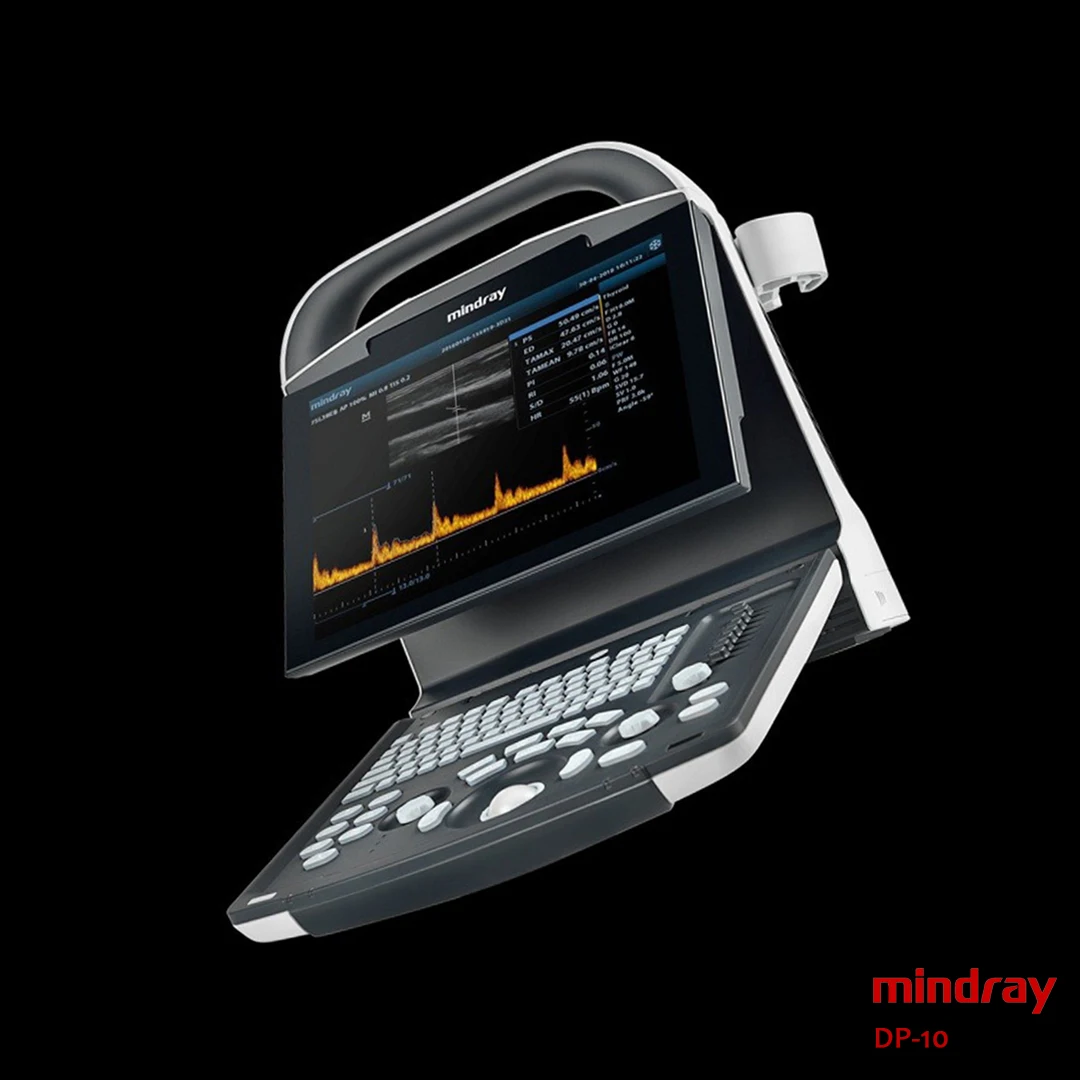 Mindray ultrasound dp 10 cheaper price Medical Ultrasound Instruments for hospital use