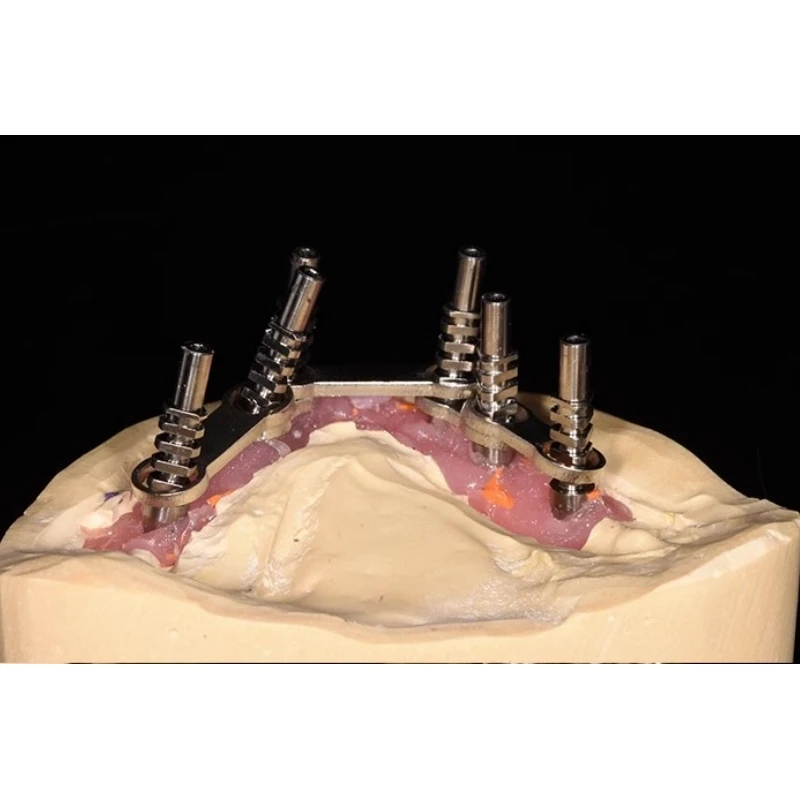 70Pcs All on 4 Dental Prosthesis Metal Implant Supported Overdenture Bar High Quality Stainless Steel All on Four