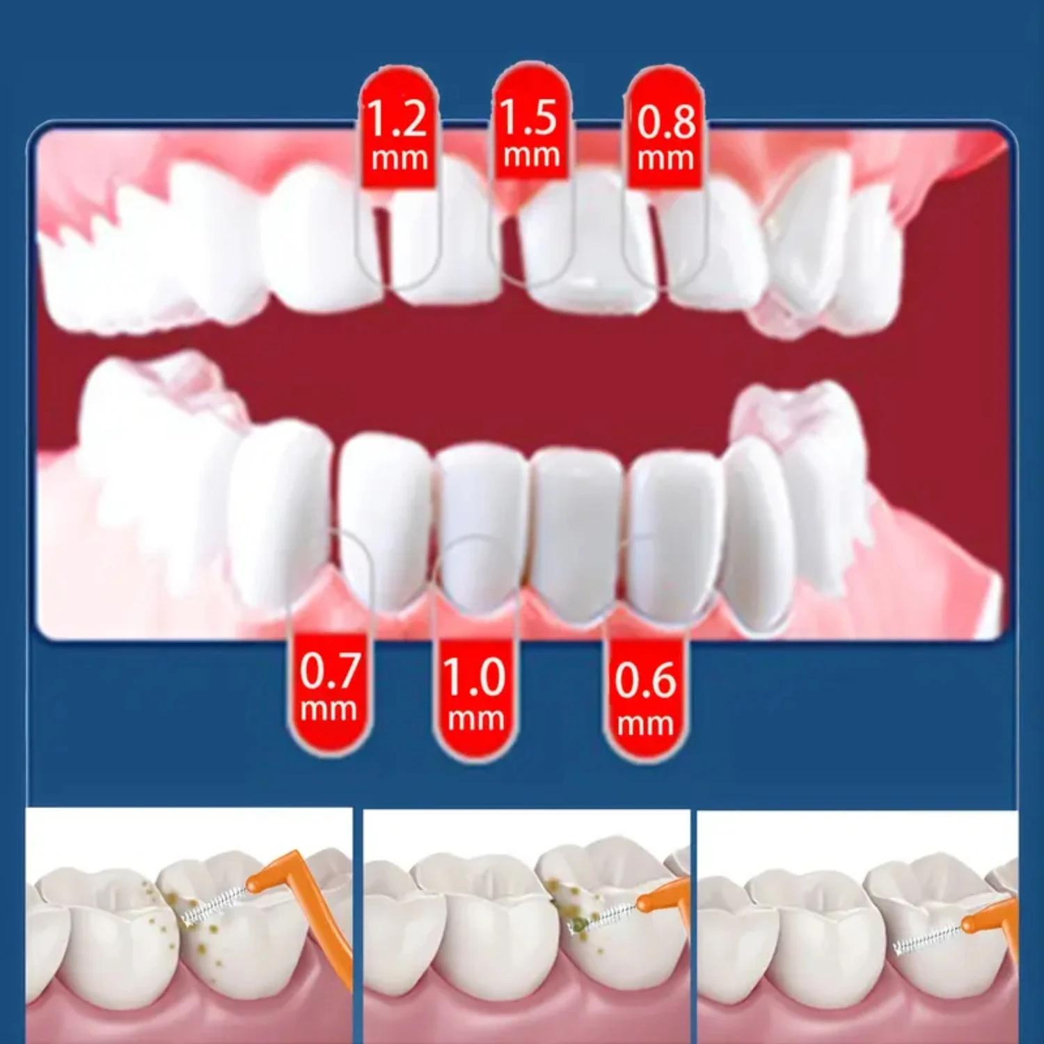 Pacote de 10 escovas interdentais em forma de L de alta qualidade para aparelho e limpeza profunda dos dentes, cada comprimento de 3,7 polegadas, Excelentes