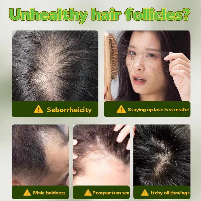 Natürliche Kräuter-Shampoo-Seife, handgemachte Usman-Gras-Seife, nährende Haare, Ölkontrolle, erfrischende, flauschige und beruhigende Haarpflege – Detail 3
