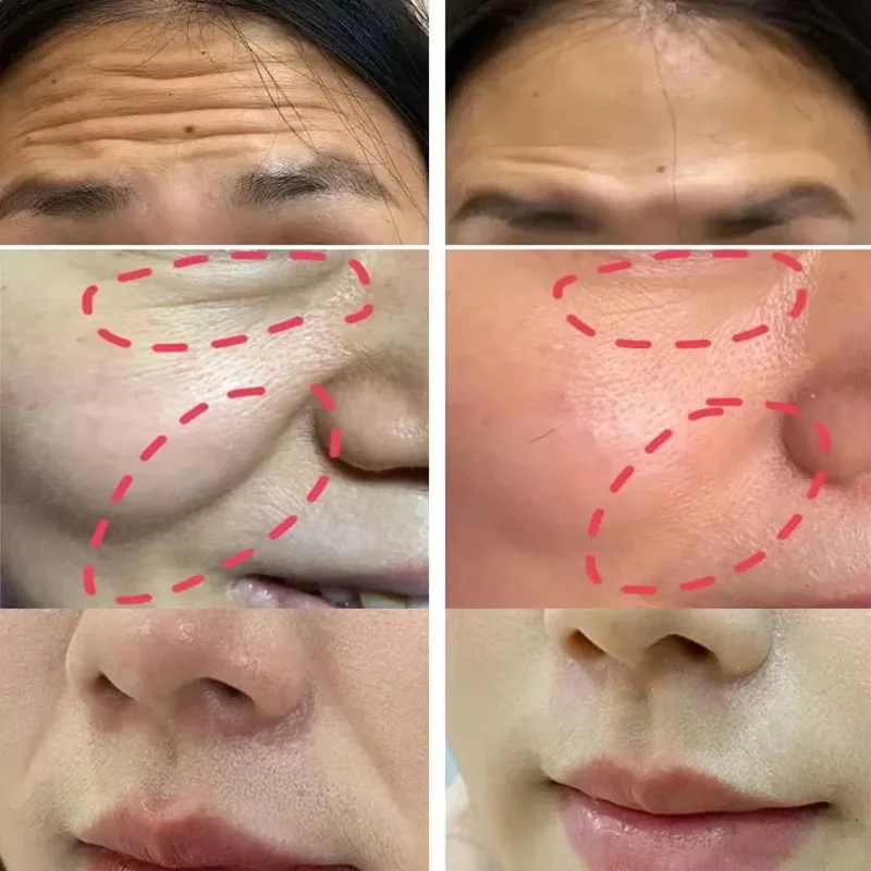 Collagen Wrinkle Removal Multi Instant Wrinkle Removal Multi Bounce Balm Remove Neck Wrinkles Firming Cream Face Moisturizer