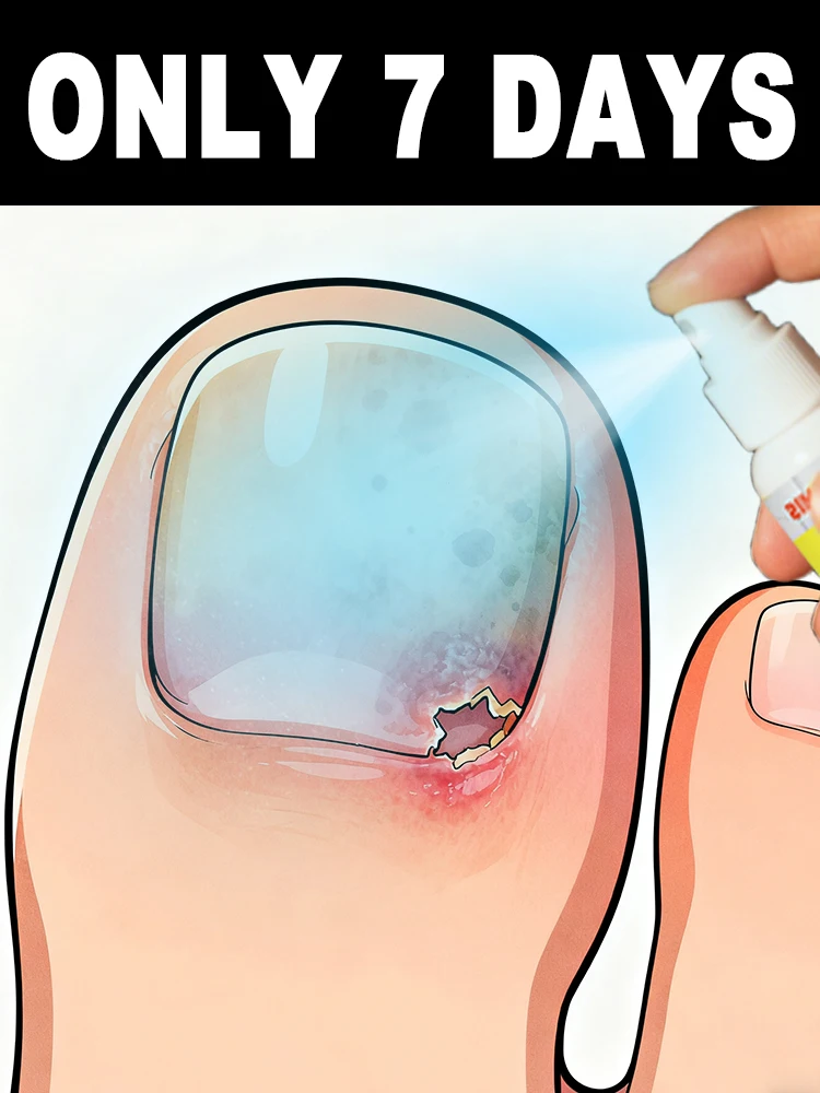 

It controls bacteria while protecting the delicate nail bedᵃⁿᵈ ᵈᵒᵉˢ ⁿᵒᵗ ⁱʳʳⁱᵗᵃᵗᵉ ᵗʰᵉ ˢᵏⁱⁿ ᵒᶠ ᵗʰᵉ