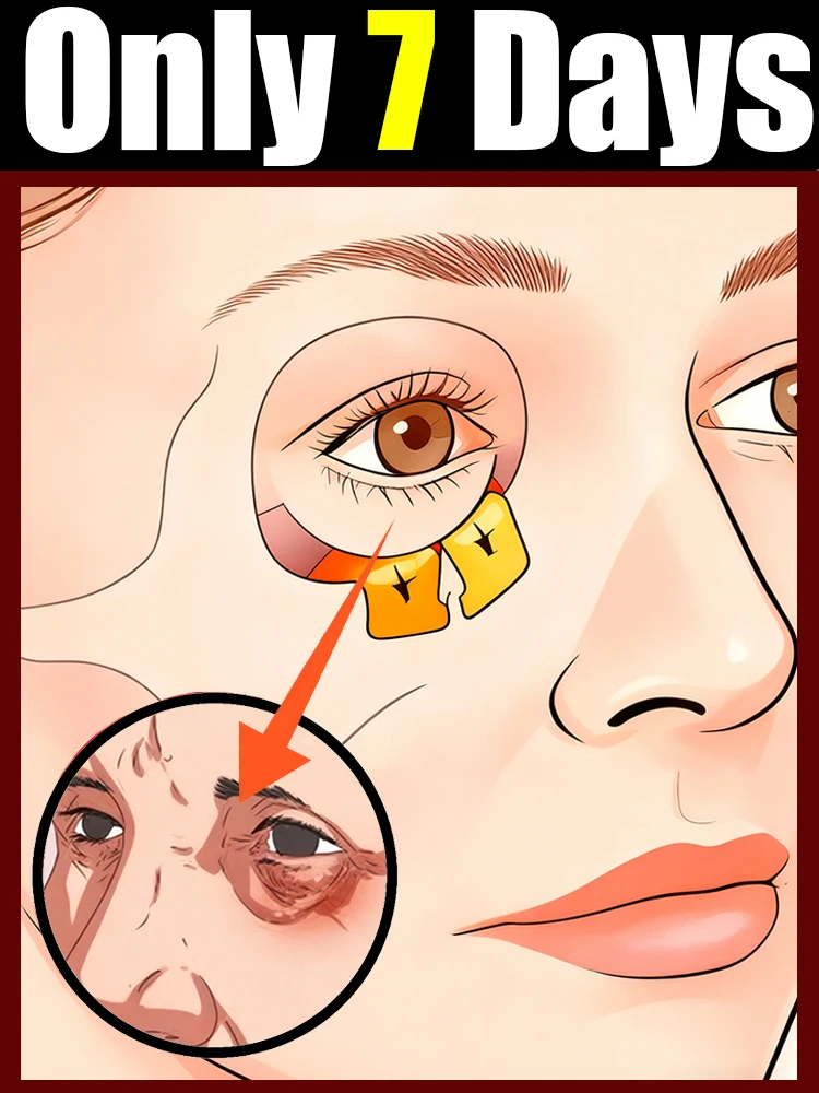 Second-generation eye cream, say goodbye to dark circles.