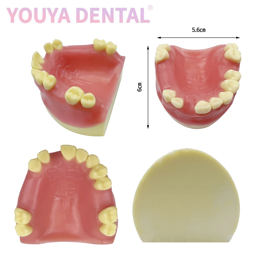 1 szt. model implantu szczękowego, w którym brakuje części model zęba z miękkimi dziąsłami, implant podstawowy model treningowy narzędzi