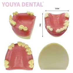 1 szt. model implantu szczękowego, w którym brakuje części model zęba z miękkimi dziąsłami, implant podstawowy model treningowy narzędzi dentystycznych