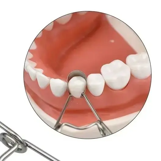 36Pcs/box Dental Saddle Contoured Metal Matrices Matrix Universal Kit with Spring Clip