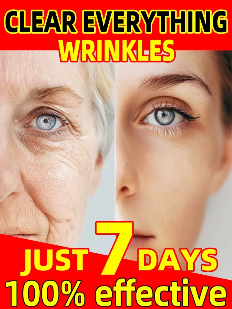 

для морщин, 20-летняя младшая