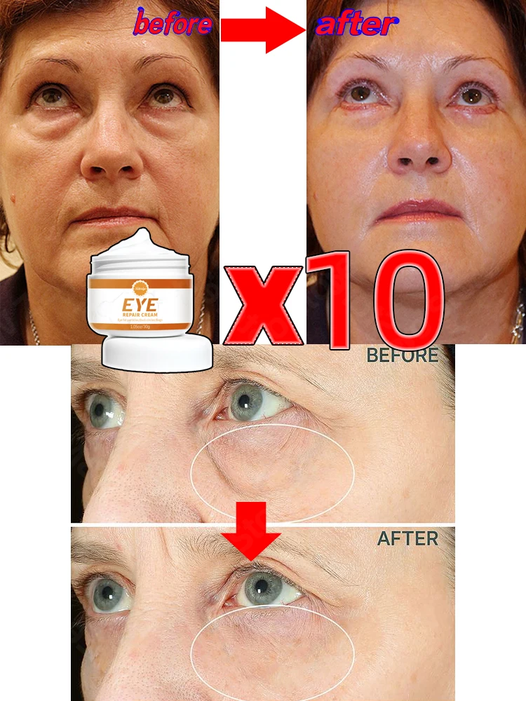 Instant Firm Eye Cream For Bags Under Eyes Dark Circles Wrinkles Under The Eyes