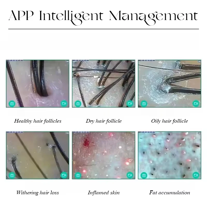محلل جلد فروة الرأس كاشف بصيلات الشعر مجهر فروة الرأس 4 الطيفية 5G WIFI ماسح الشعر التطبيق التشخيصي أرشيف العملاء #4