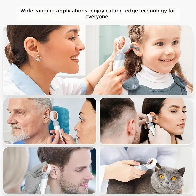 for Handheld Ear Canal Detector with Screen for Tonsil Stone Removal  Endoscope Smart Display Portable