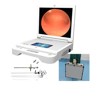 shrek hot selling medial surgery product portable hysteroscop endoscope system