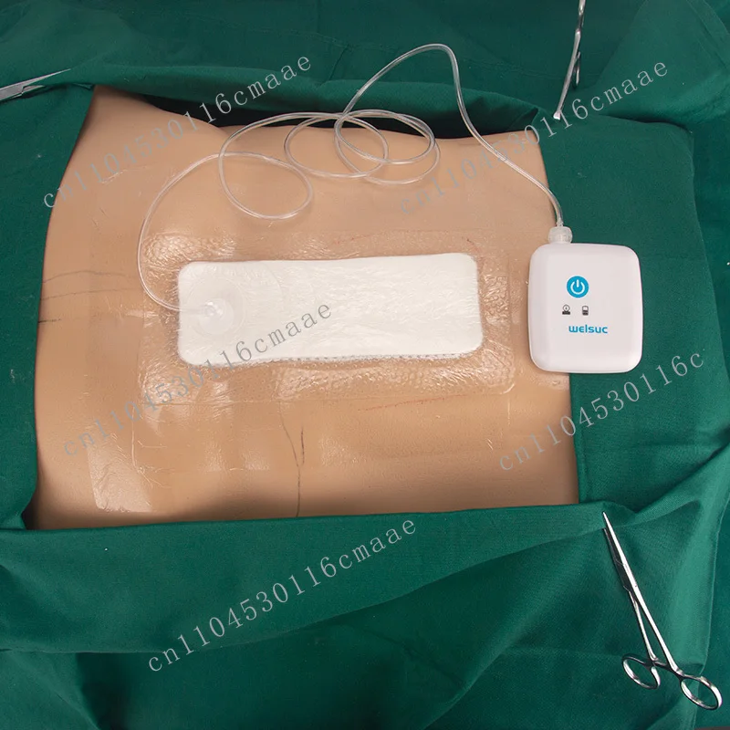 NPWT System 15x20cm Dressing Kit A-1 for Certified Negative Pressure Wound Therapy Machine Consumables for Wound