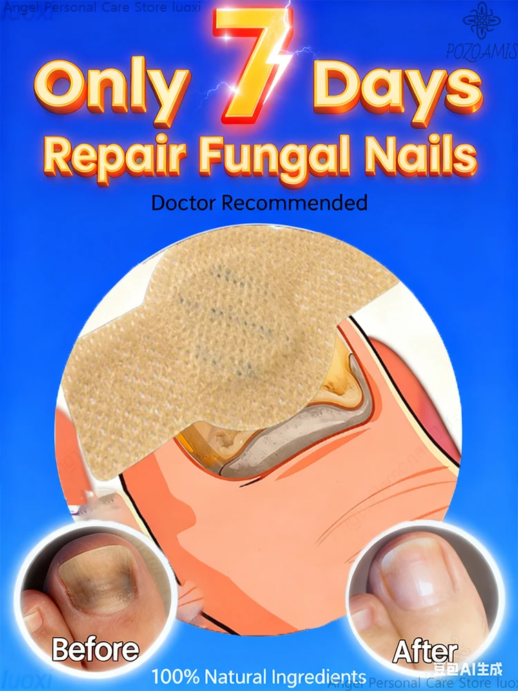 修理ステッカー、爪の修復に使用でき、使いやすく、素早く、べたつかない