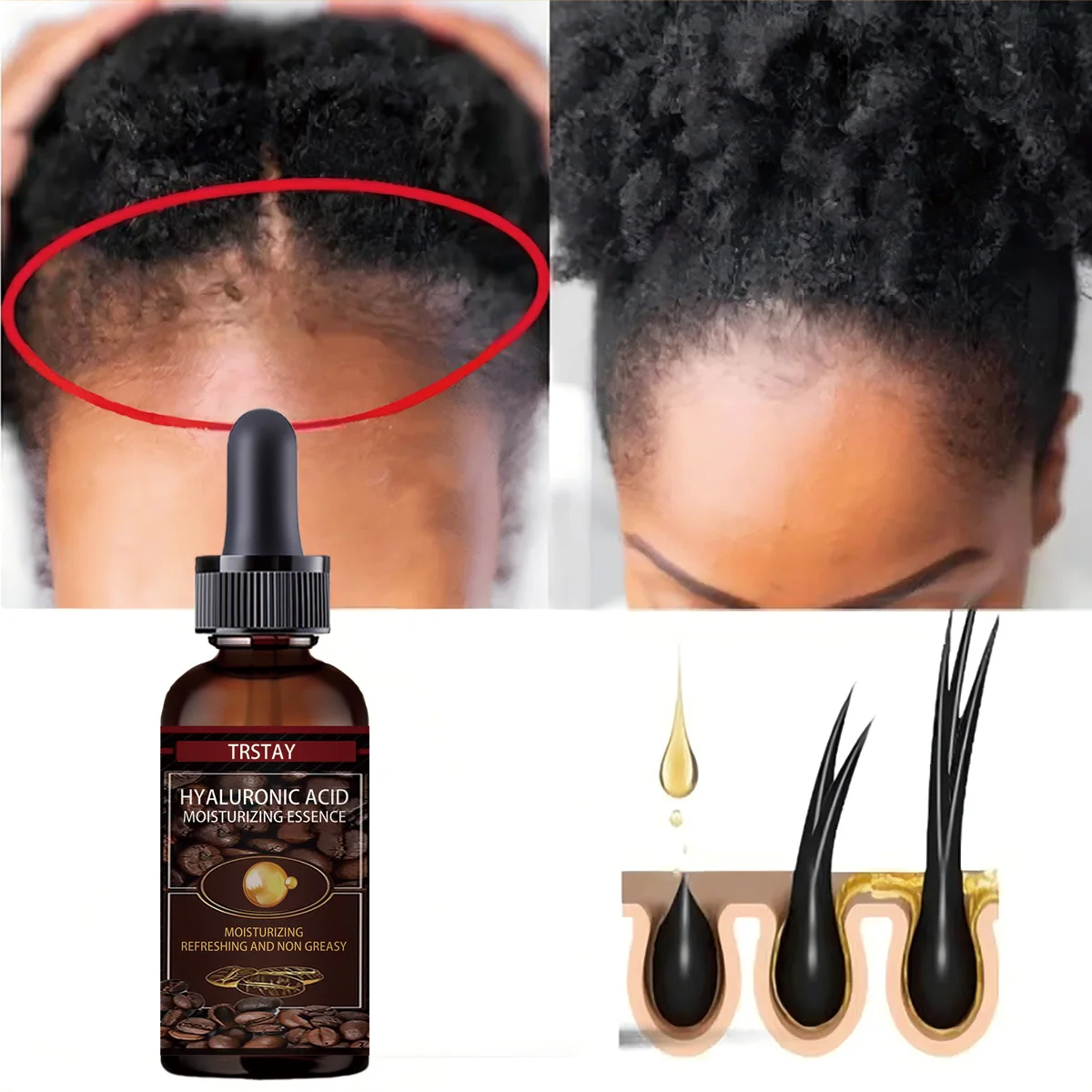 

Alopecia Hair Treatment for Women Hairloss Hair Oil Growth Tool Spray Caffeine for Treatment Dry Frizzy Damaged Thin Hair Care