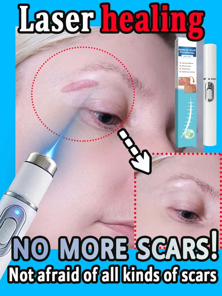 laser scar 𝗦𝗰𝗮𝗿 𝗿𝗲𝗰𝗼𝘃𝗲𝗿𝘆 𝗾𝘂𝗶𝗰𝗸 𝗿𝗲𝗺𝗼𝘃𝗮𝗹 𝗼𝗳 𝘀𝘂𝗿𝗴𝗶𝗰𝗮𝗹 𝘀𝗰𝗮𝗿𝘀 𝘀𝘁𝗿𝗲𝘁𝗰𝗵 𝗺𝗮𝗿𝗸𝘀 𝗯𝘂𝗿